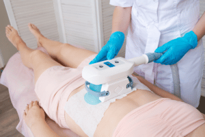 CoolSculpting Marketing Forecast and Trends for 2023